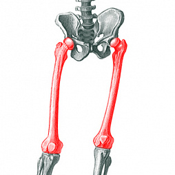 Накостный остеосинтез бедренной кости